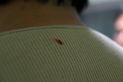 2006년 7월 1일 인도네시아에서 순례오신 신부님의 티셔츠 목 뒤쪽에 내려오신 성혈