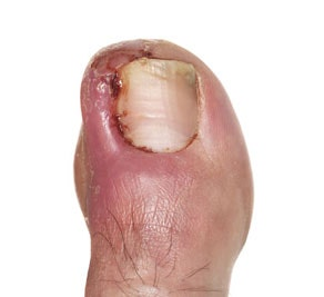 a860a1e1ddf7f.png