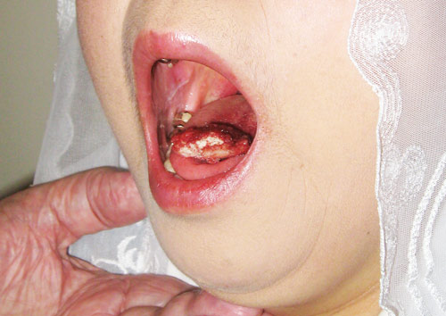 3a24c2f16c199.jpg