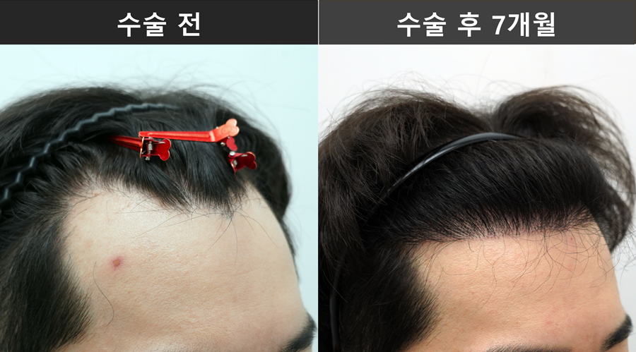 4622d09d87cd1.png