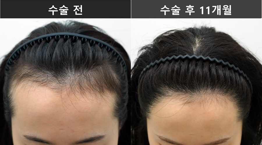 81e16baf59d30.jpg