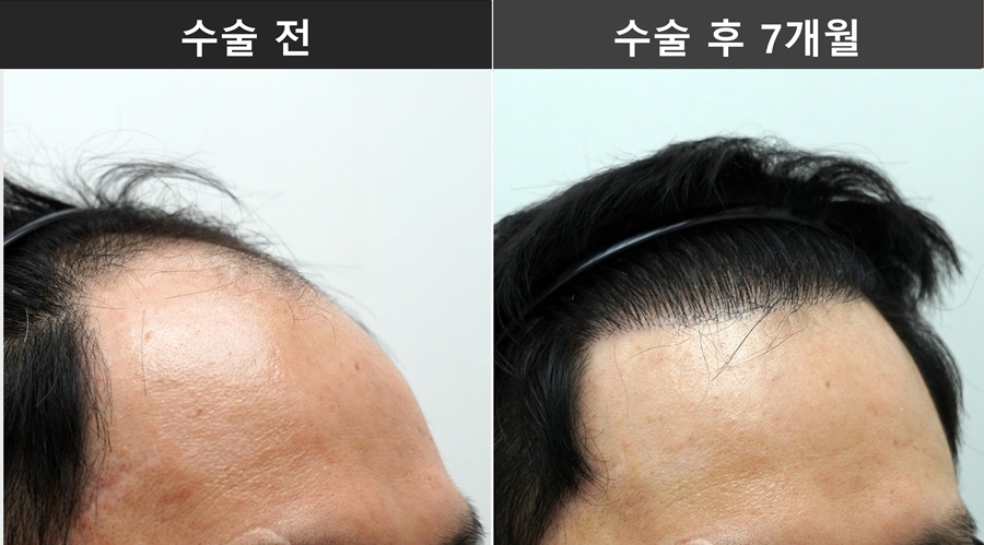 98272d5cf7fda.jpg