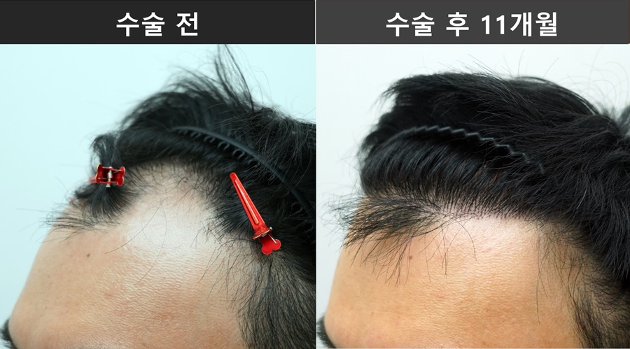 9bd728646a57f.jpg