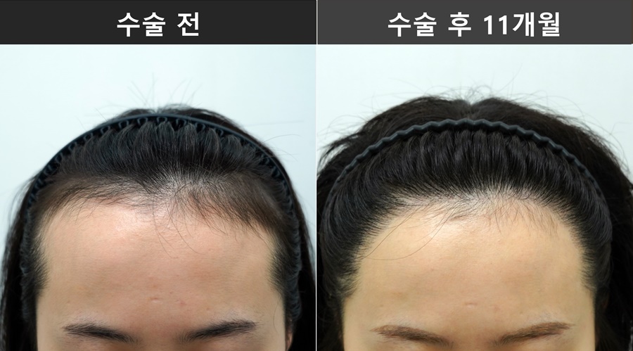 a50642cd8fc30.jpg