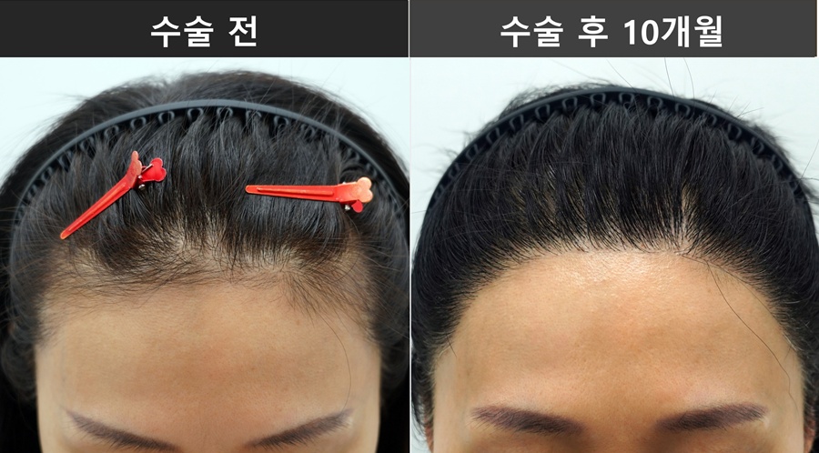 bfb237911d6fb.jpg