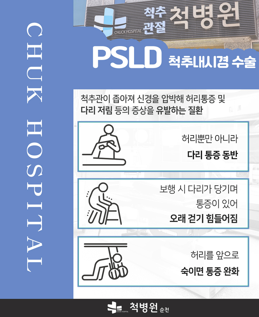 협착증, 수술이 정답일까? 비수술 Psld 그 시술 방법은? : 소셜채널