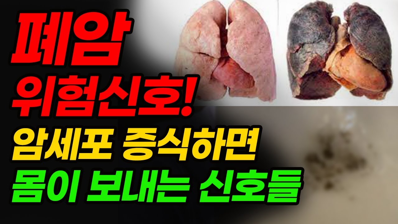 클릭하면 유튜브 영상을 시청할 수 있습니다. 폐암에 대해서 다룬 컨텐츠입니다.