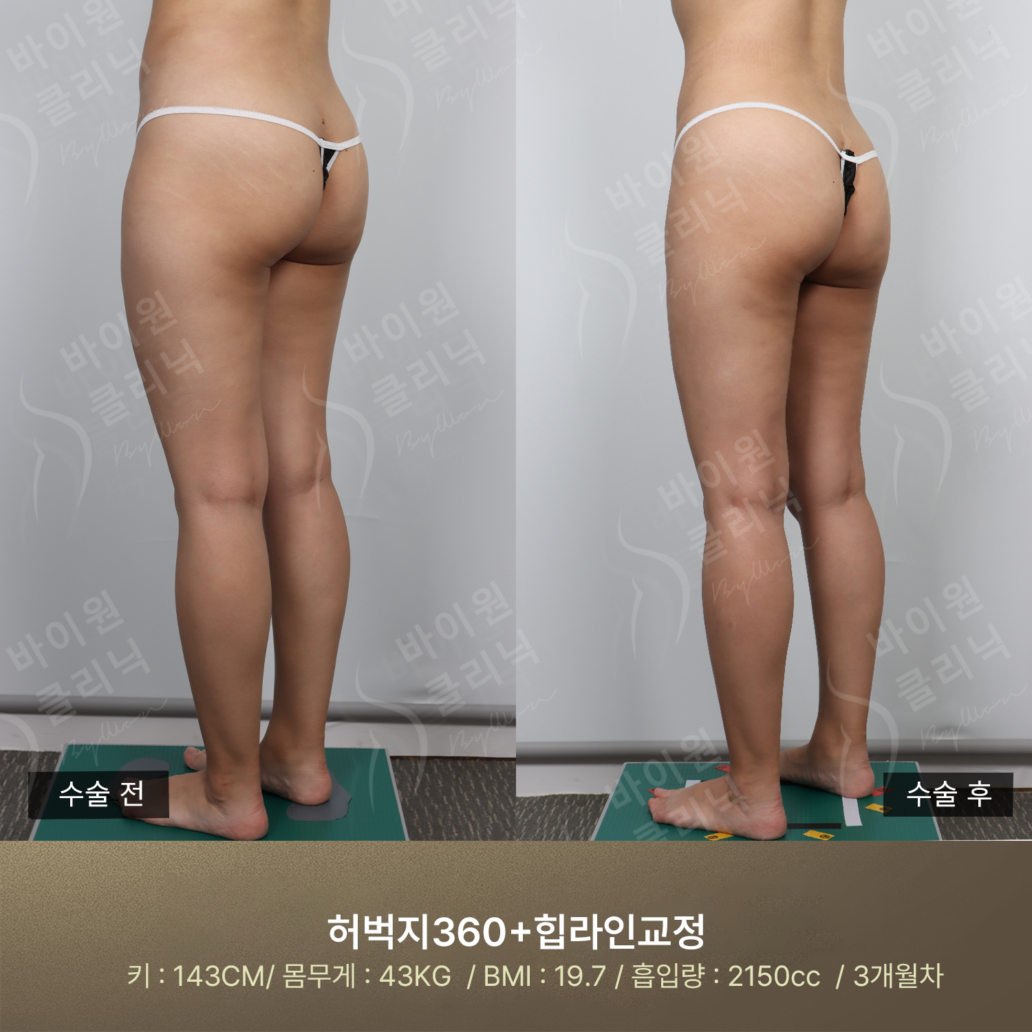 036be514130b6.png