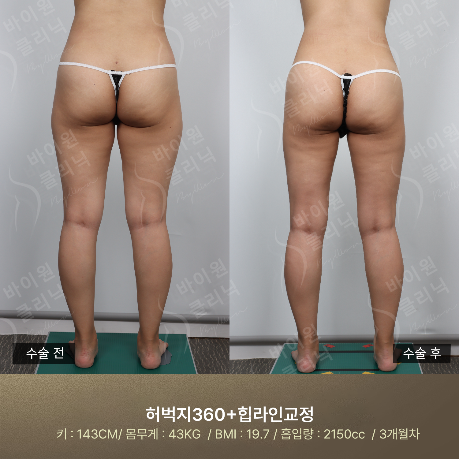 07a03144adb2e.png