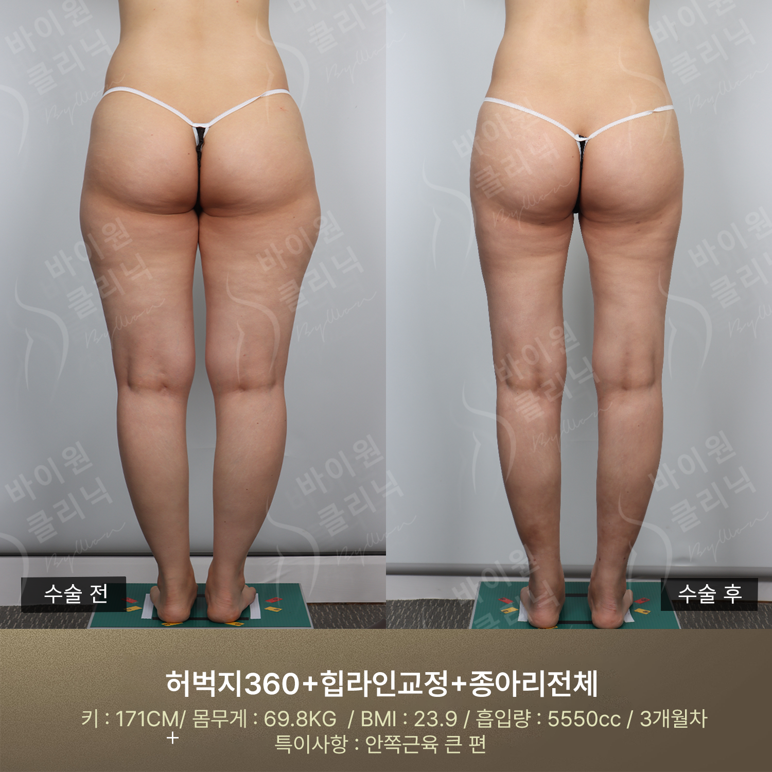 255a5fb665a12.png