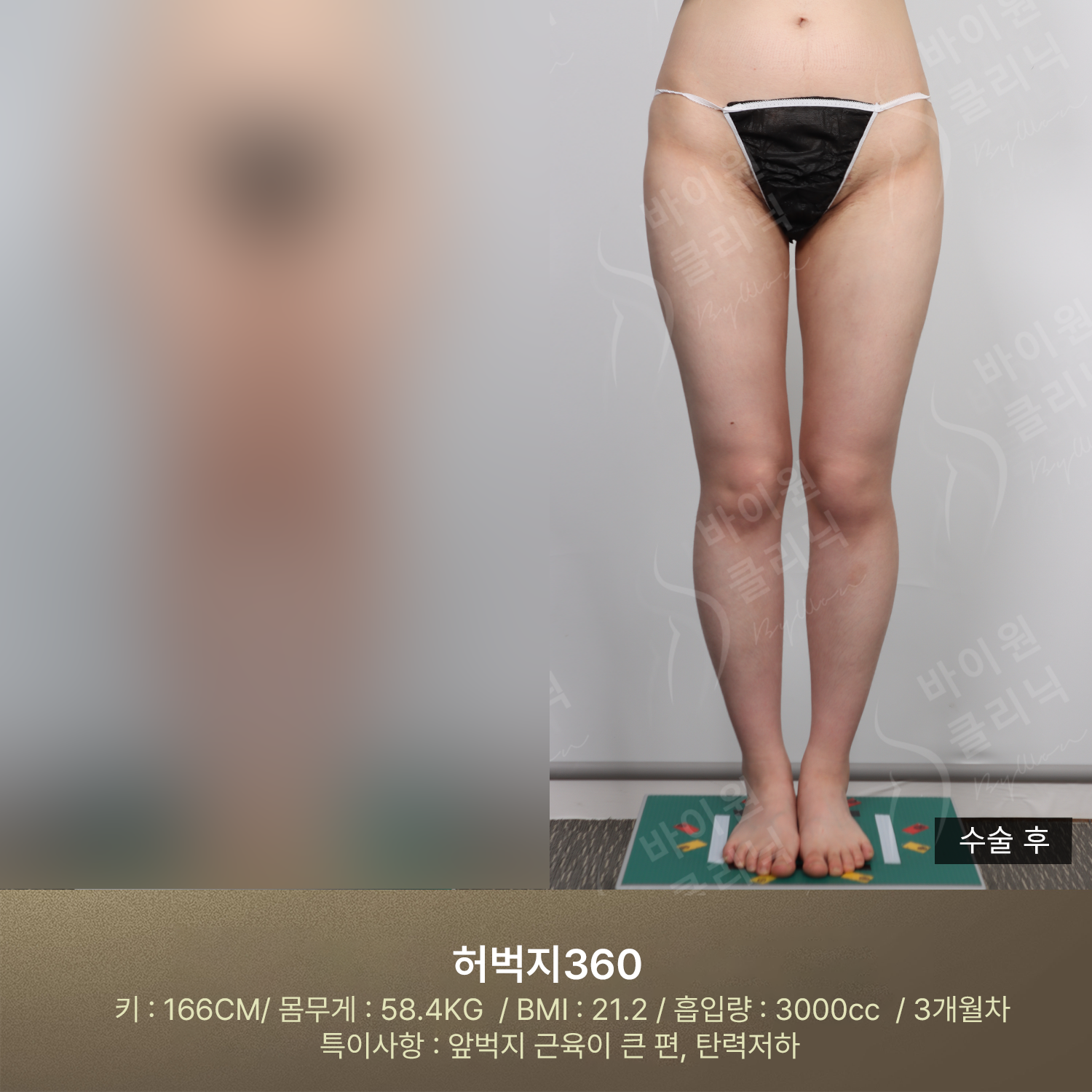 48bbed3f93774.png