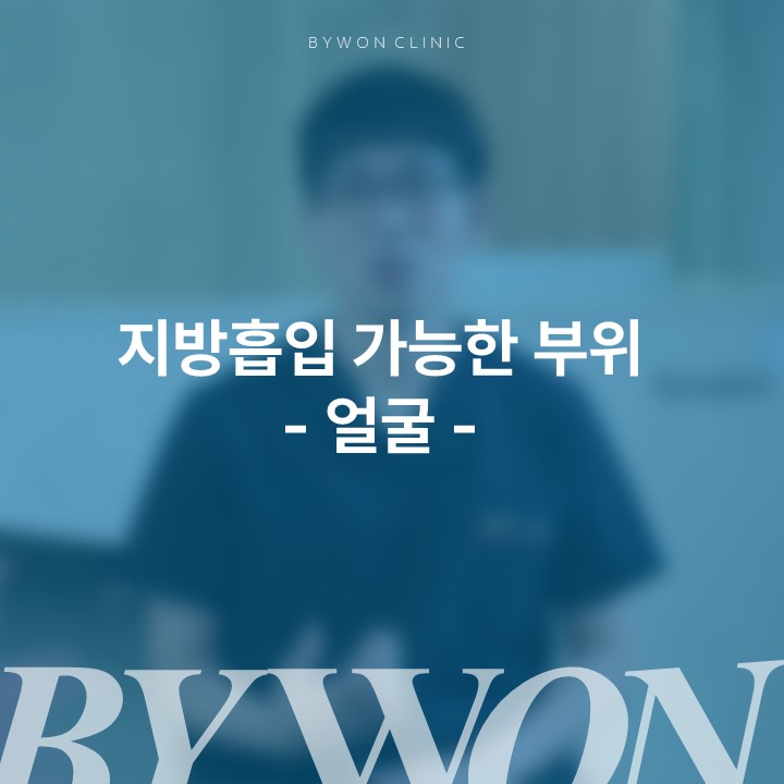 5a92dfa156d66.jpg