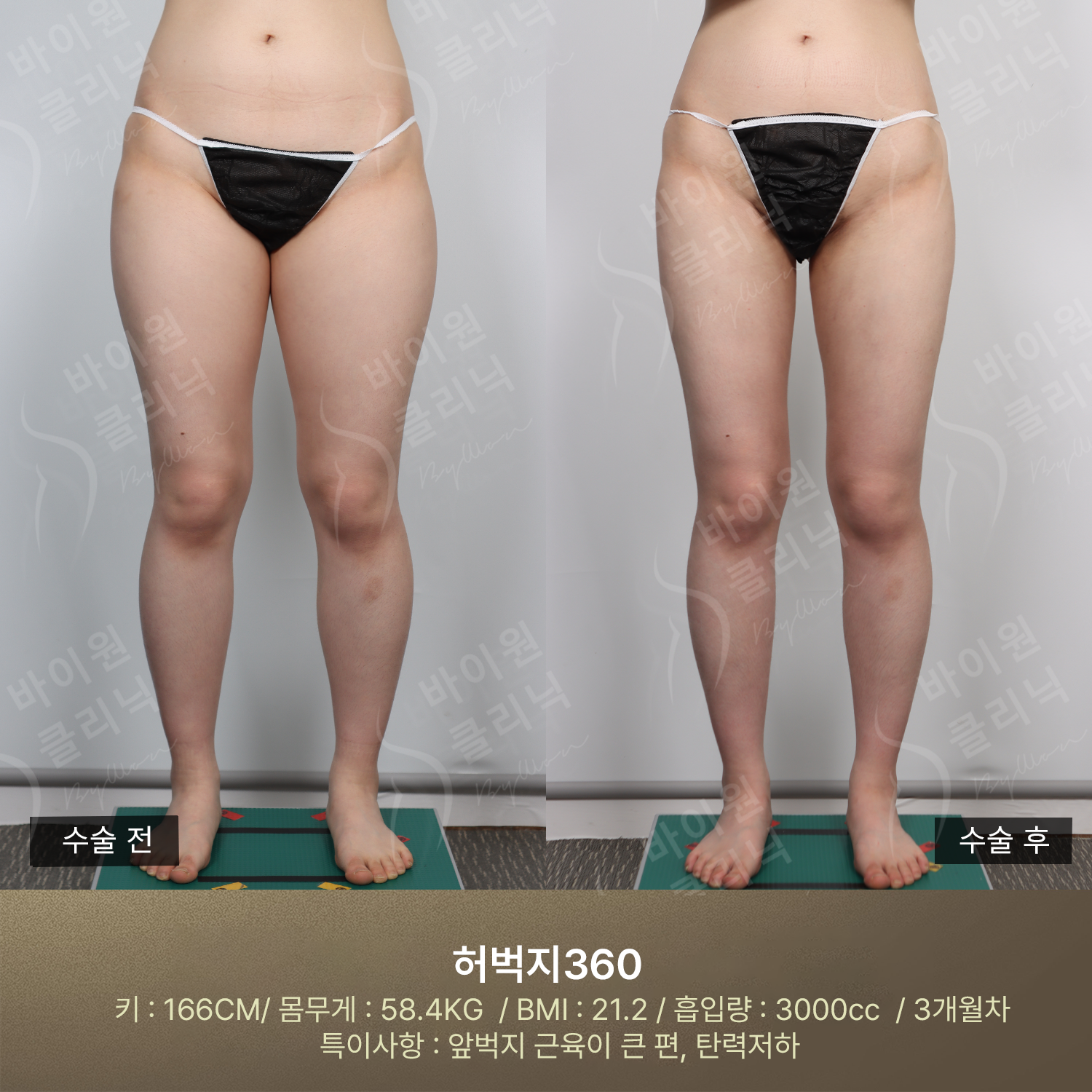 811101bef6a5f.png