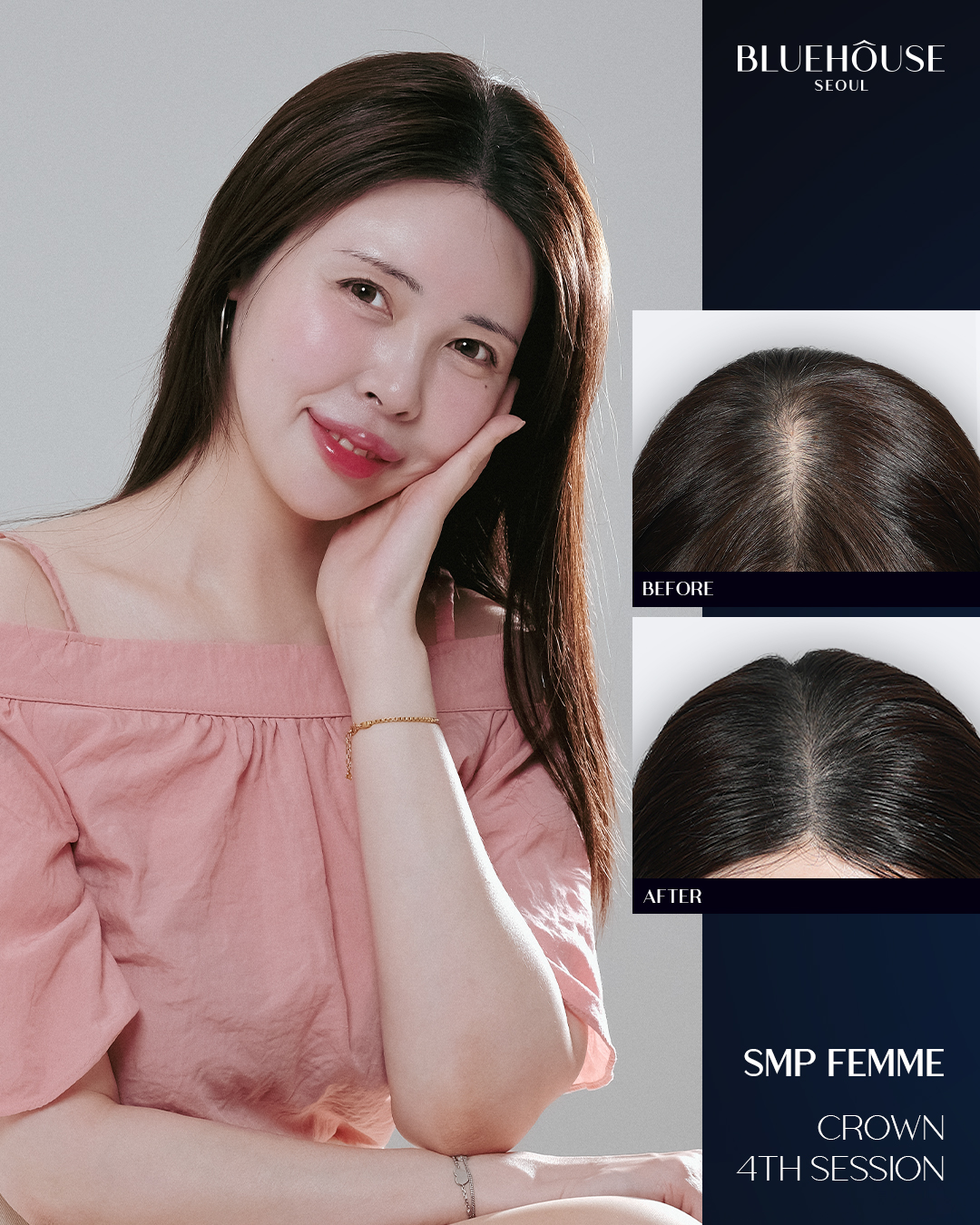 이제님 후기