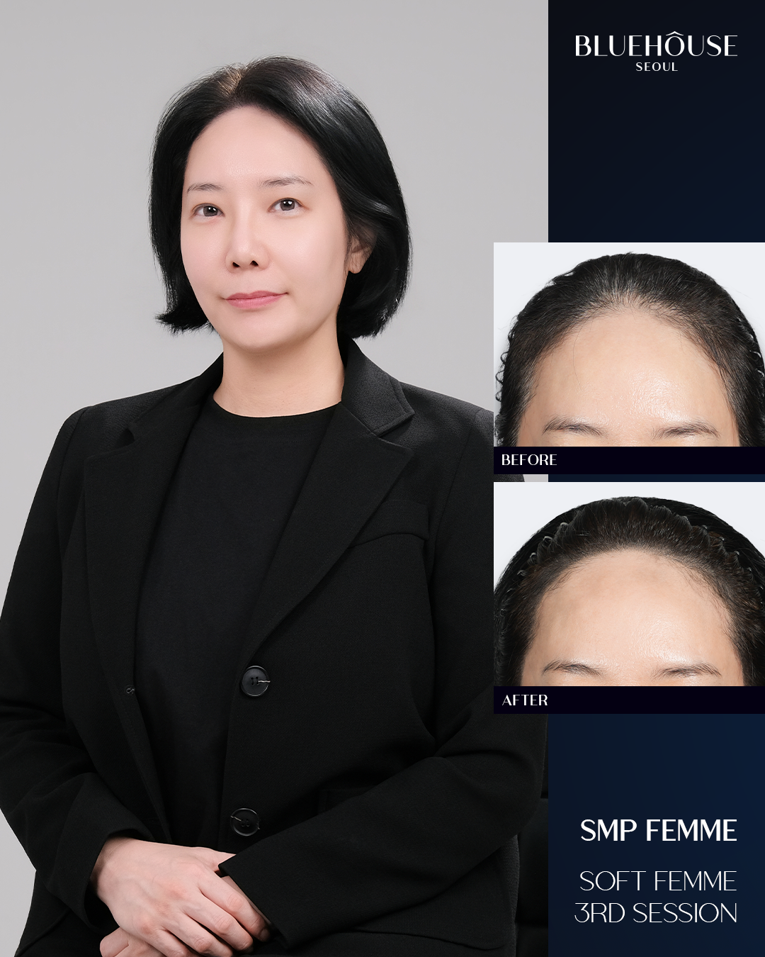 이제님 후기
