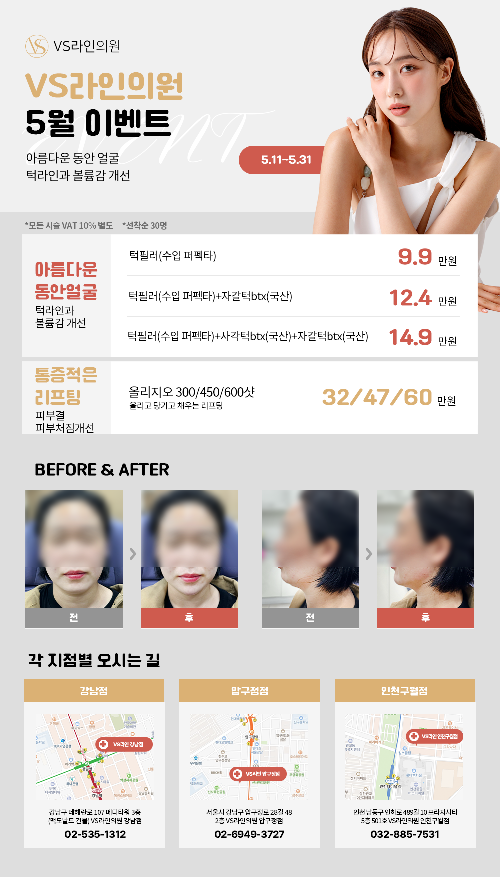 2023년 5월 VS라인 깜짝이벤트 : VS라인 압구정점 - 이벤트/PRICE