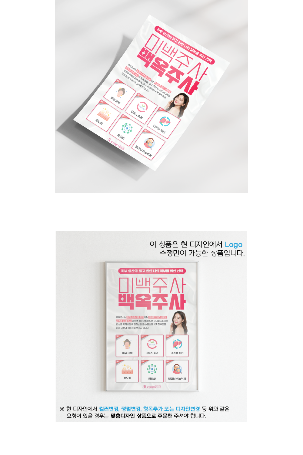 알레르기비염