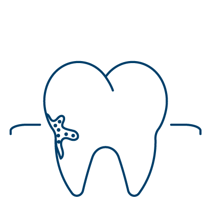 남천동-광안리치과-유엘치과-잇몸치료-치석제거