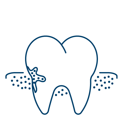 남천동-광안리치과-유엘치과-잇몸치료-염증제거