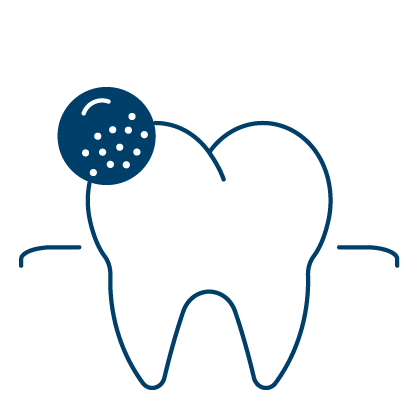 남천동-광안리치과-유엘치과-스케일링-충치예방