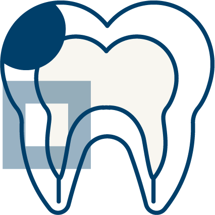 남천동-광안리치과-유엘치과-충치치료-내부충치