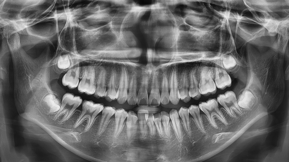 남천동-광안리치과-유엘치과-구강관리-CT검사
