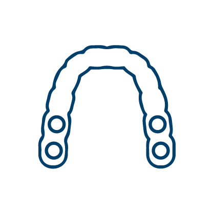 남천동-광안리치과-유엘치과-임플란트-네비게이션임플란트