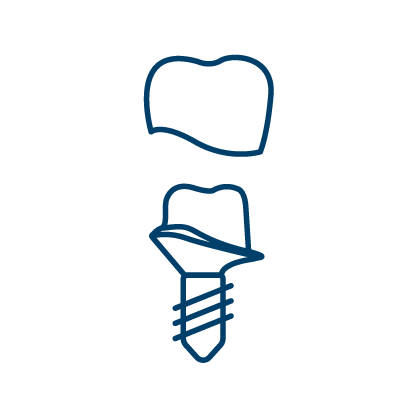 남천동-광안리치과-유엘치과-임플란트-맞춤형임플란트