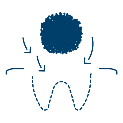 남천동-광안리치과-유엘치과-임플란트-뼈이식여부