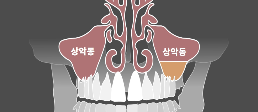 0259837b266cd.png