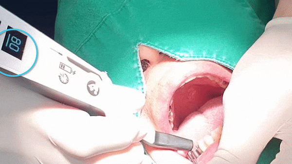 453b75a8e7eff.gif