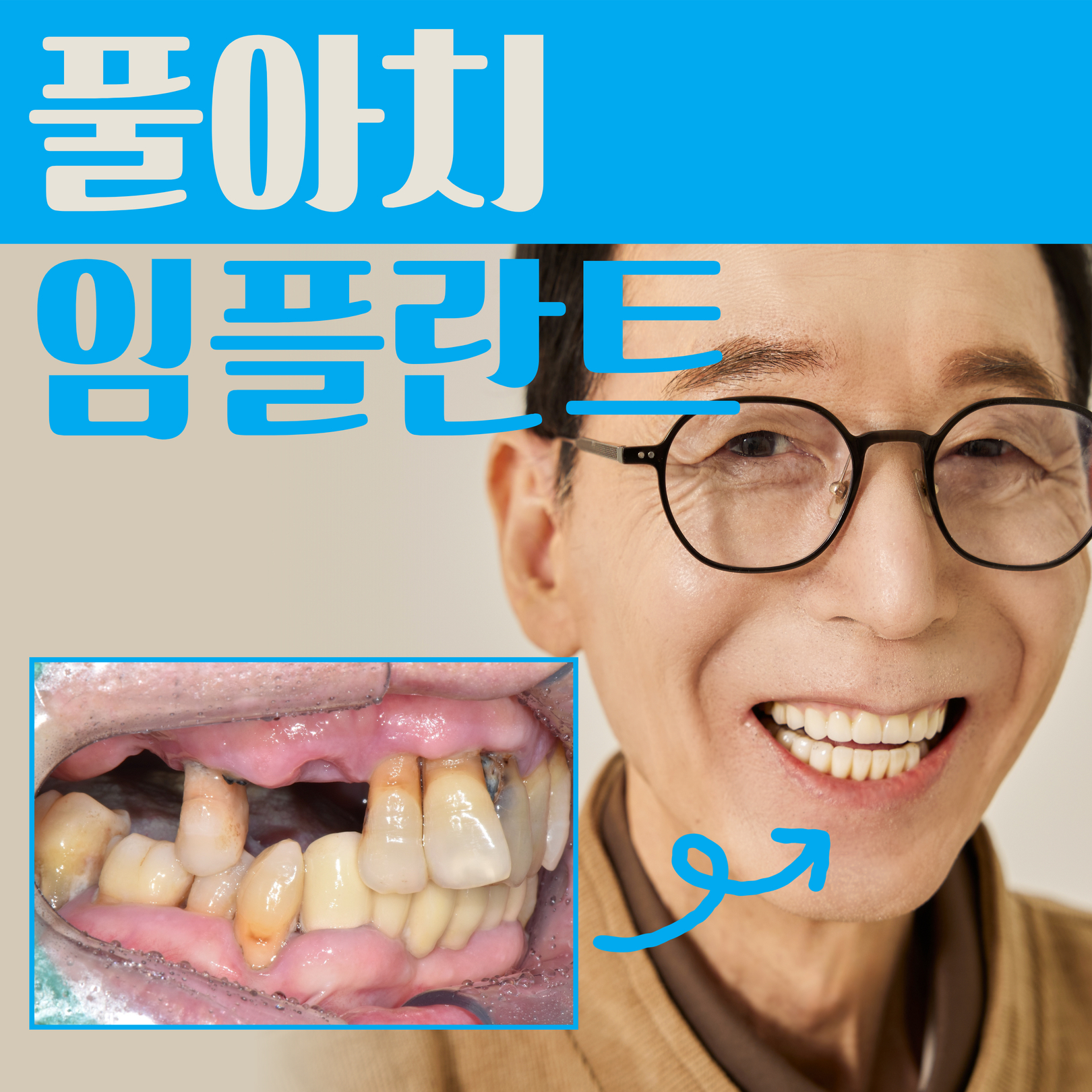 4b933872a4a1f.jpg