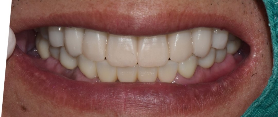 5235393de9e66.jpg