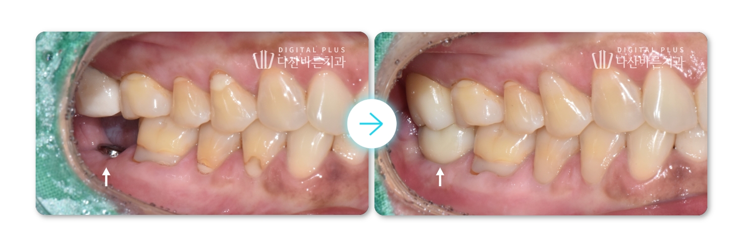 987c4912ff998.jpg