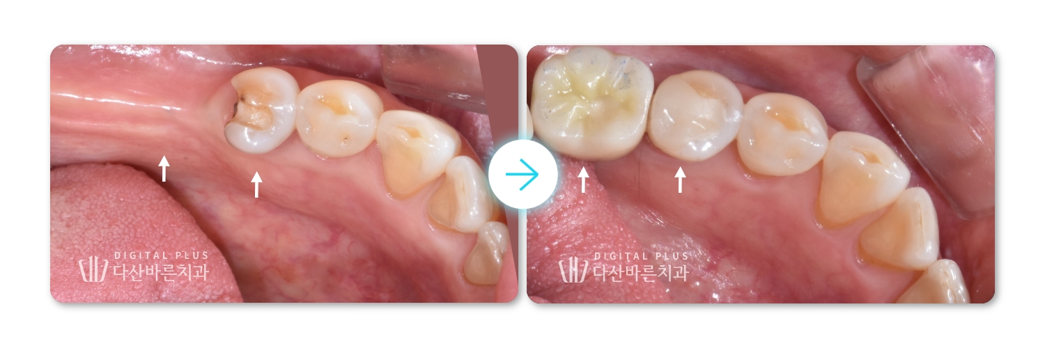 a0c14795cdf72.jpg