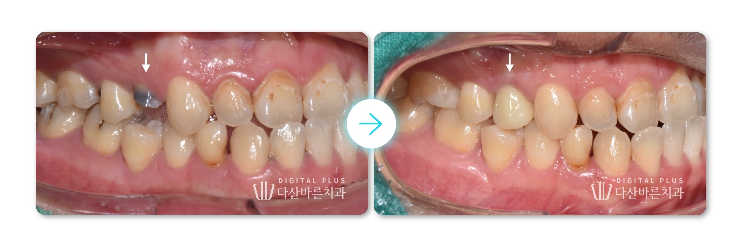 b844117dd300f.jpg