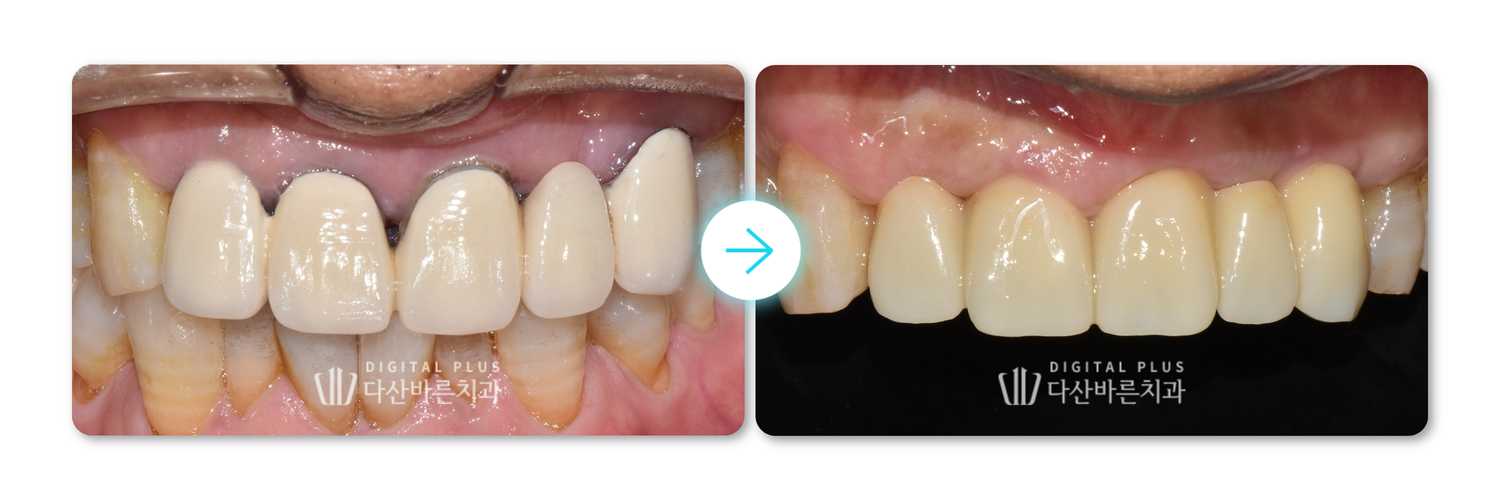 c6032adf6614a.jpg