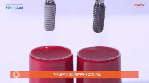 f44d0ebc234ed.gif