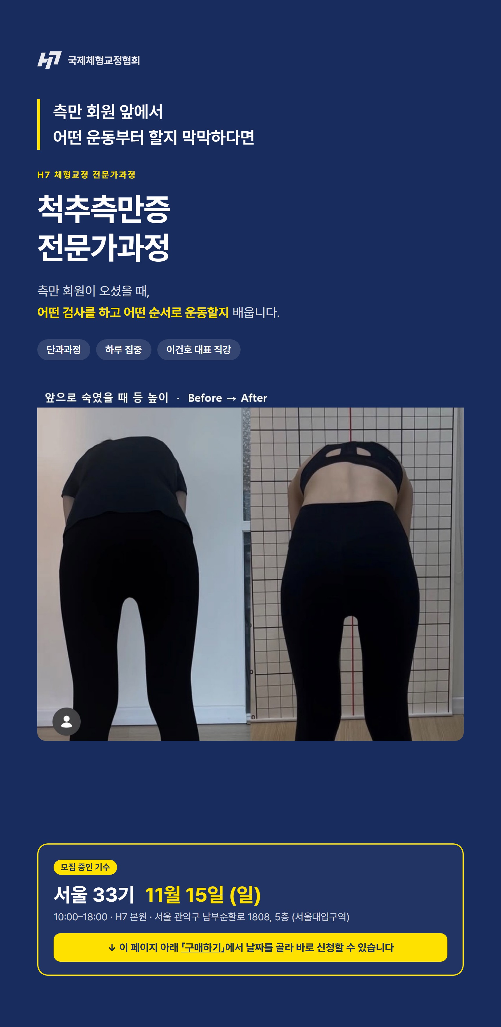 척추측만증 전문가과정 33기 서울 [11월 15일]