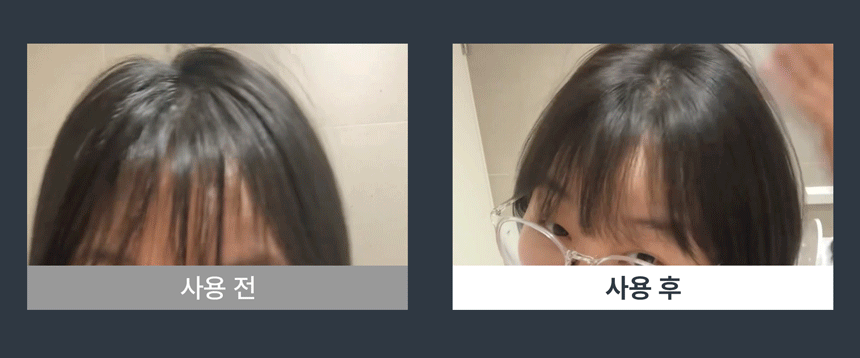 유아른 비건 드라이 샴푸 앰플 40ml