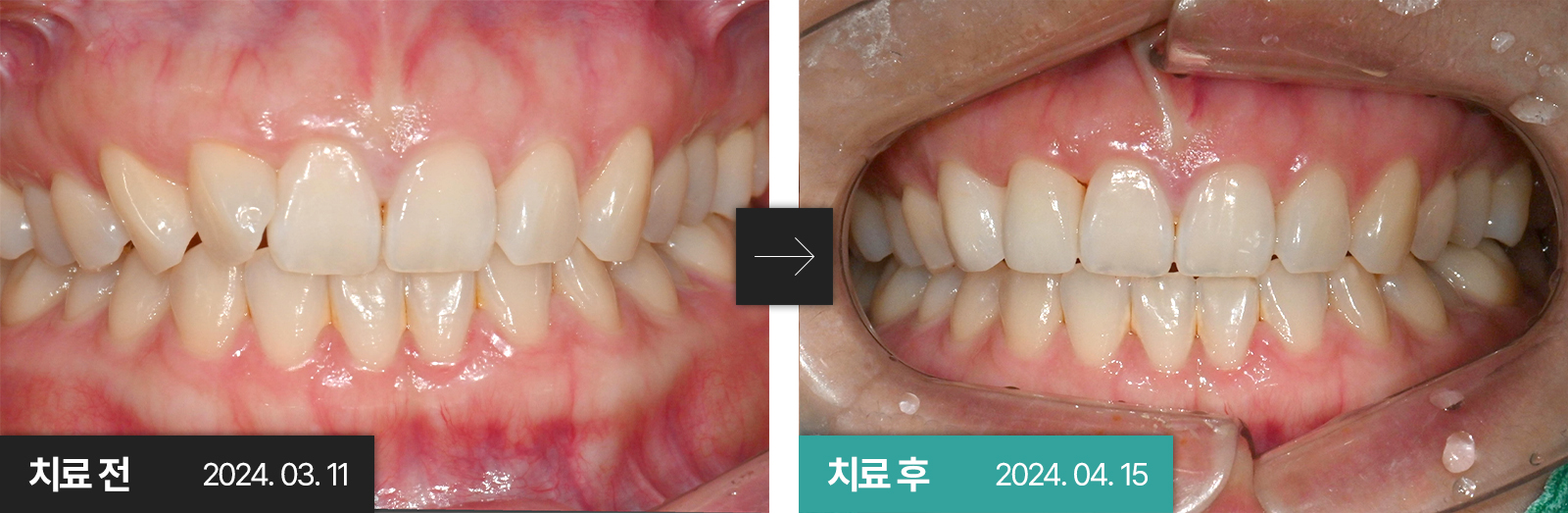 067d9b775bedf.jpg