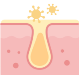 8aed6d1114a1c.png