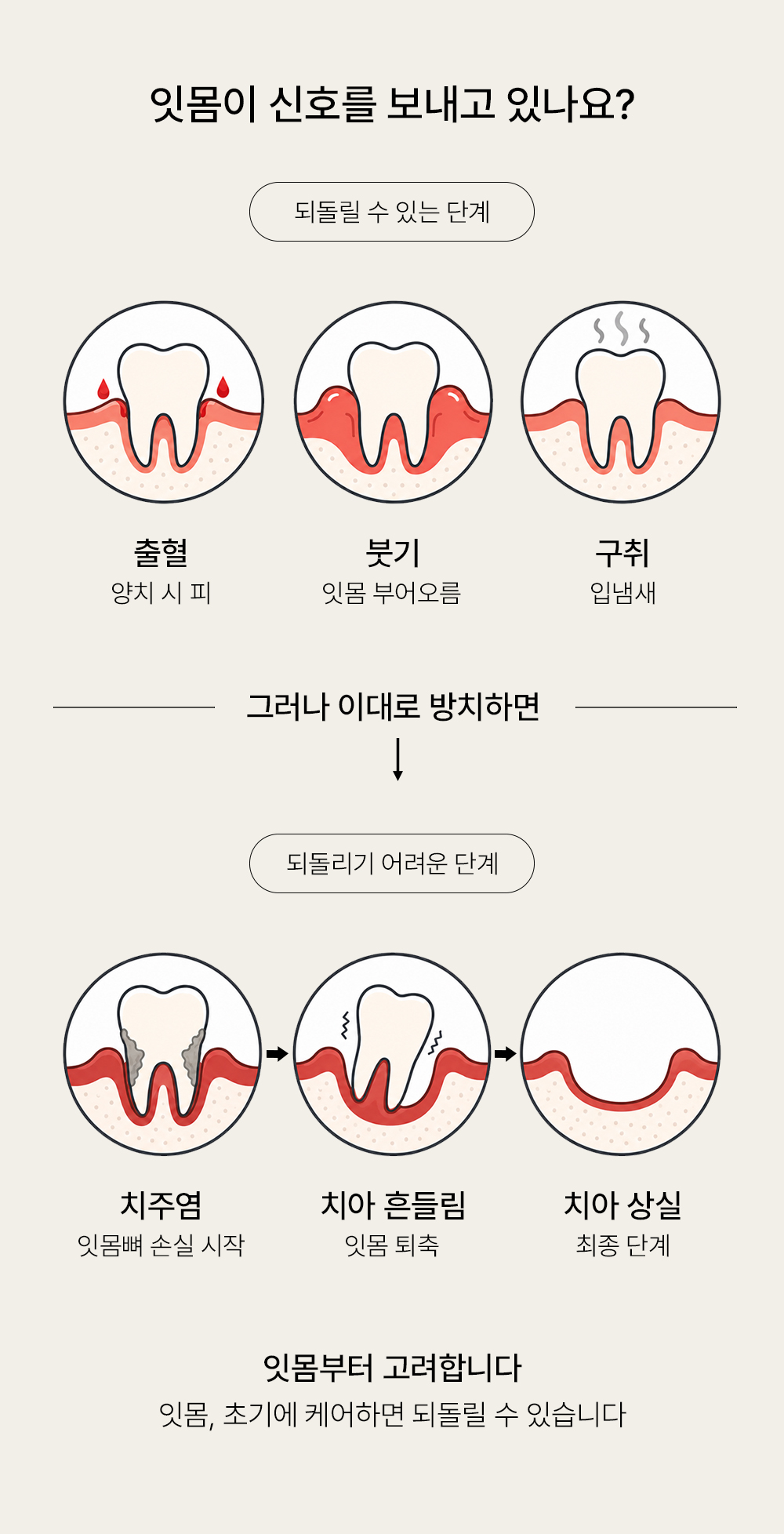 소나무소금 1.5% 잇몸 케어 가글 30개입