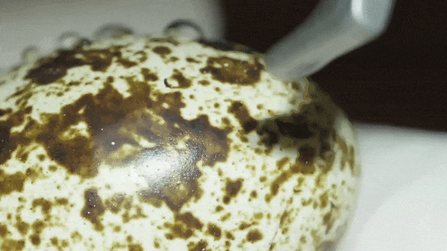 시흥치과 스케일링