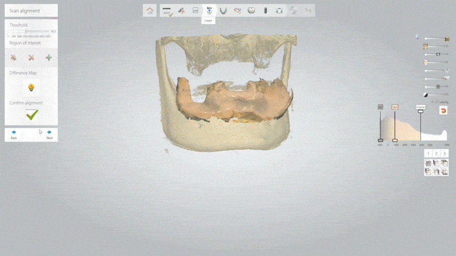 시흥치과 임플란트