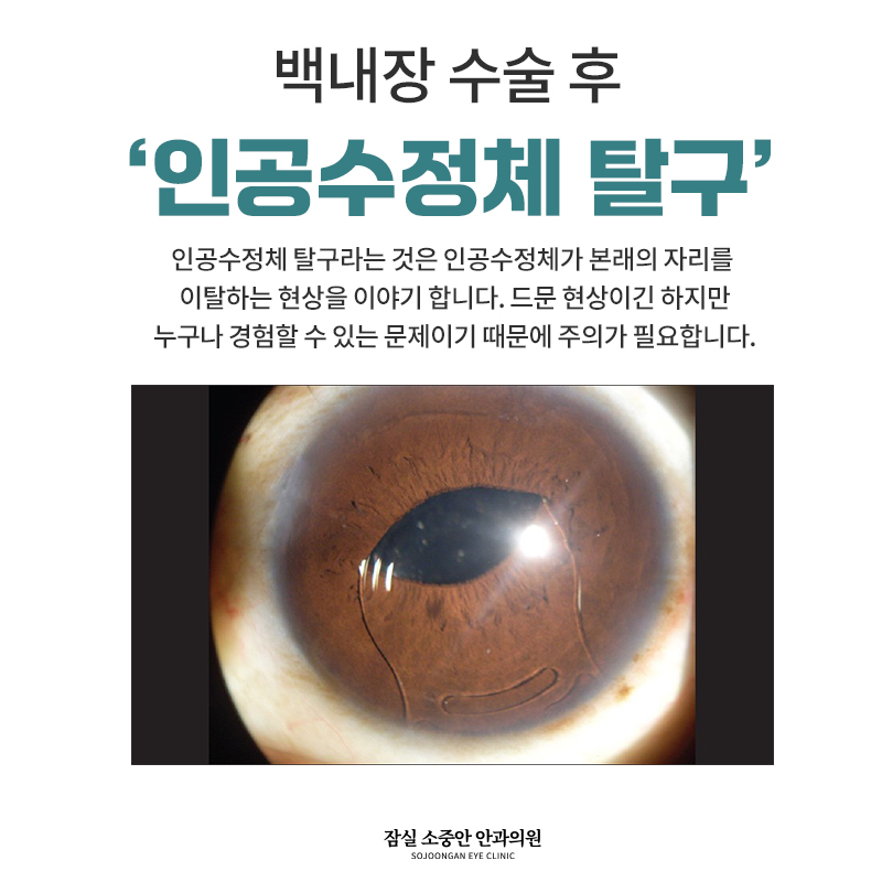 ae20fd2907533.jpg