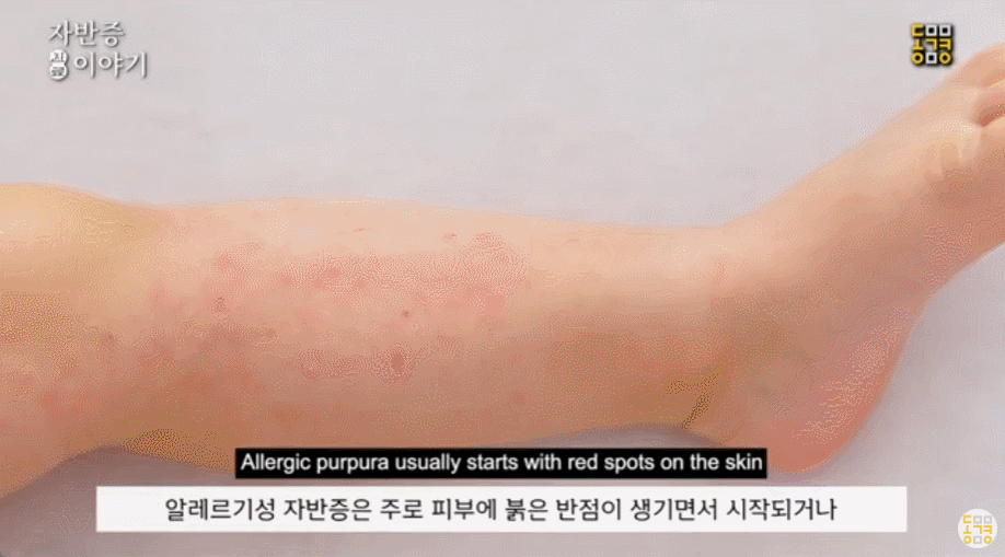 557e9ec03117b.gif