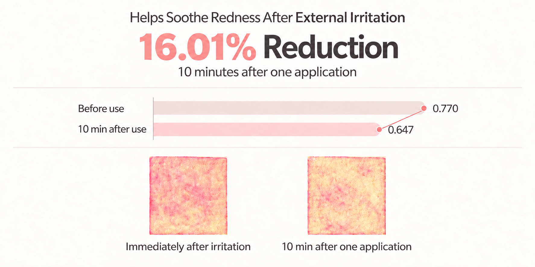 Essence B redness reduction clinical result
