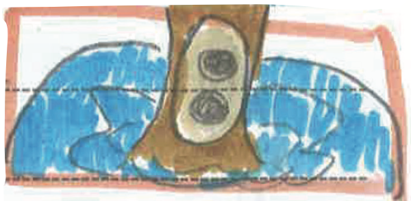 9558701fca33f.png