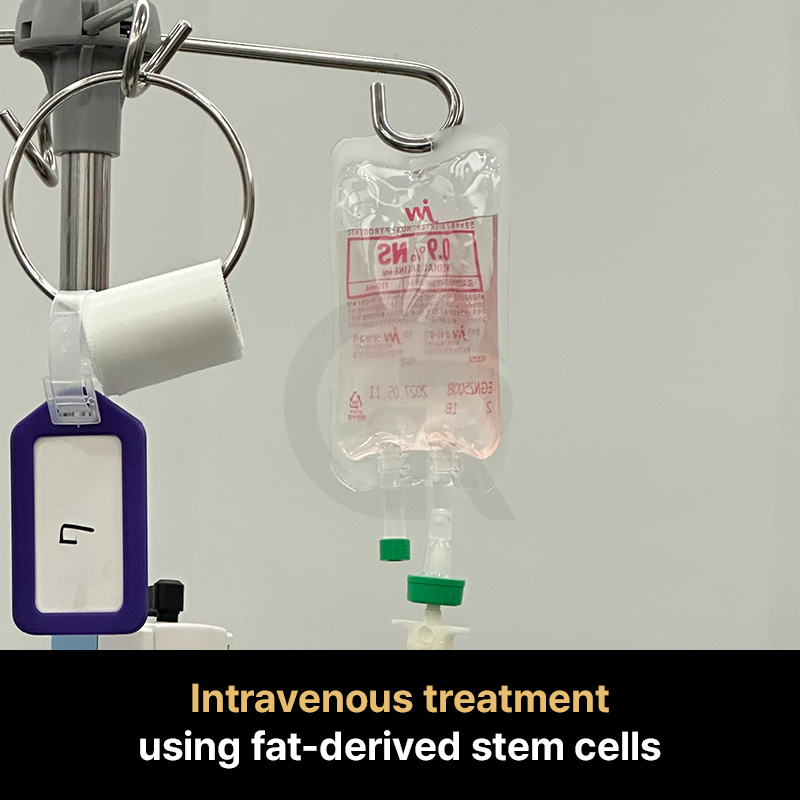 A patient’s experience with fat-derived stem cell therapy in Korea involves careful evaluation and individualized planning.
